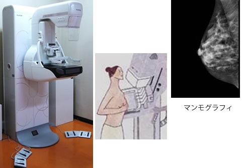 乳房撮影装置